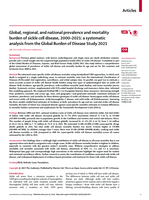 Global, regional, and national prevalence and mortality burden of sickle cell disease, 2000–2021: a systematic analysis from the Global Burden of Disease Study 2021